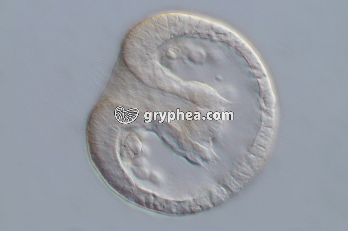 Oursin - Larve de type Gastrula (Paracentrotus lividus) x150 - gryphea.org